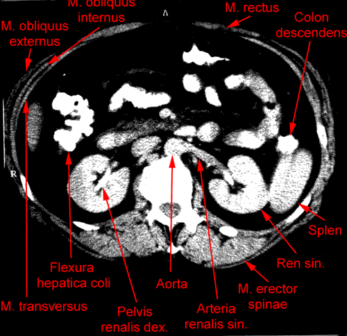 anatomia radiologiczna - 7.gif